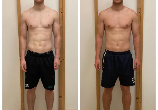 Yannick before-after vooraanzicht